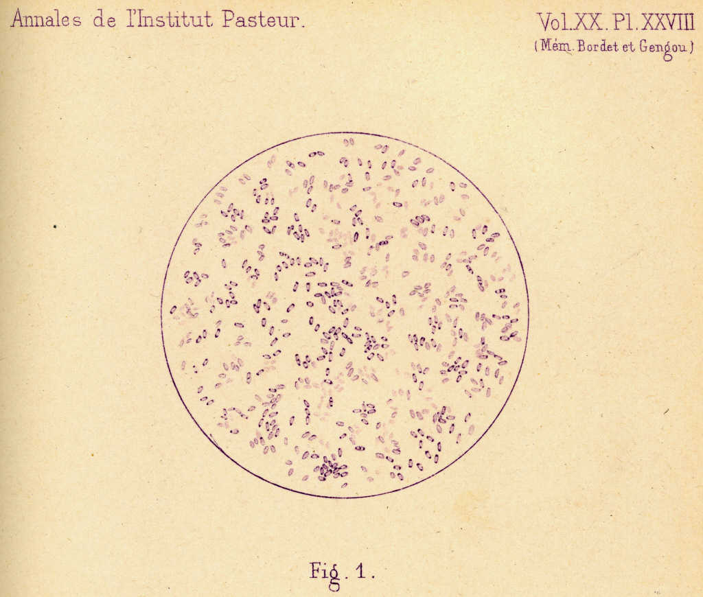 Bordet - Coqueluche - Institut Pasteur Bordet - Coqueluche - Institut Pasteur