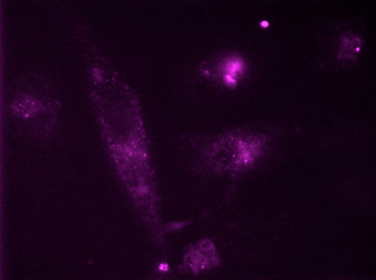 Les lymphocytes CD4 peuvent présenter des mutations au niveau du corécepteur CCR5 - © Institut Pasteur Les lymphocytes CD4 peuvent présenter des mutations au niveau du corécepteur CCR5 - © Institut Pasteur