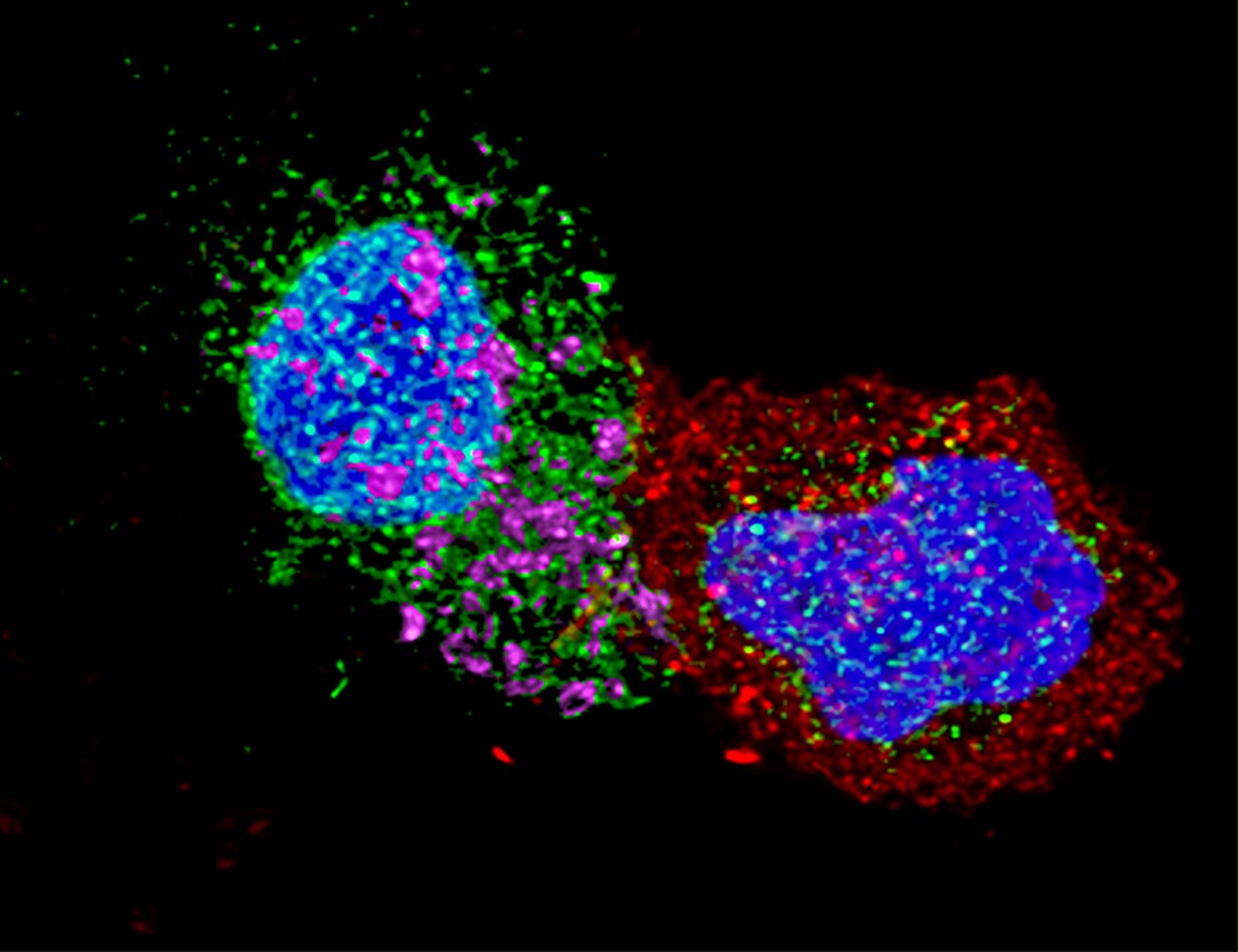 LTCD8 rentre en contact avec un LTCD4 infecté par le VIH - © Institut Pasteur LTCD8 rentre en contact avec un LTCD4 infecté par le VIH - © Institut Pasteur