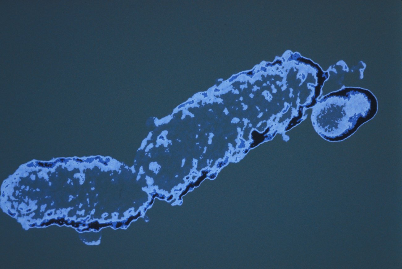 Bordetella pertussis Bordetella pertussis