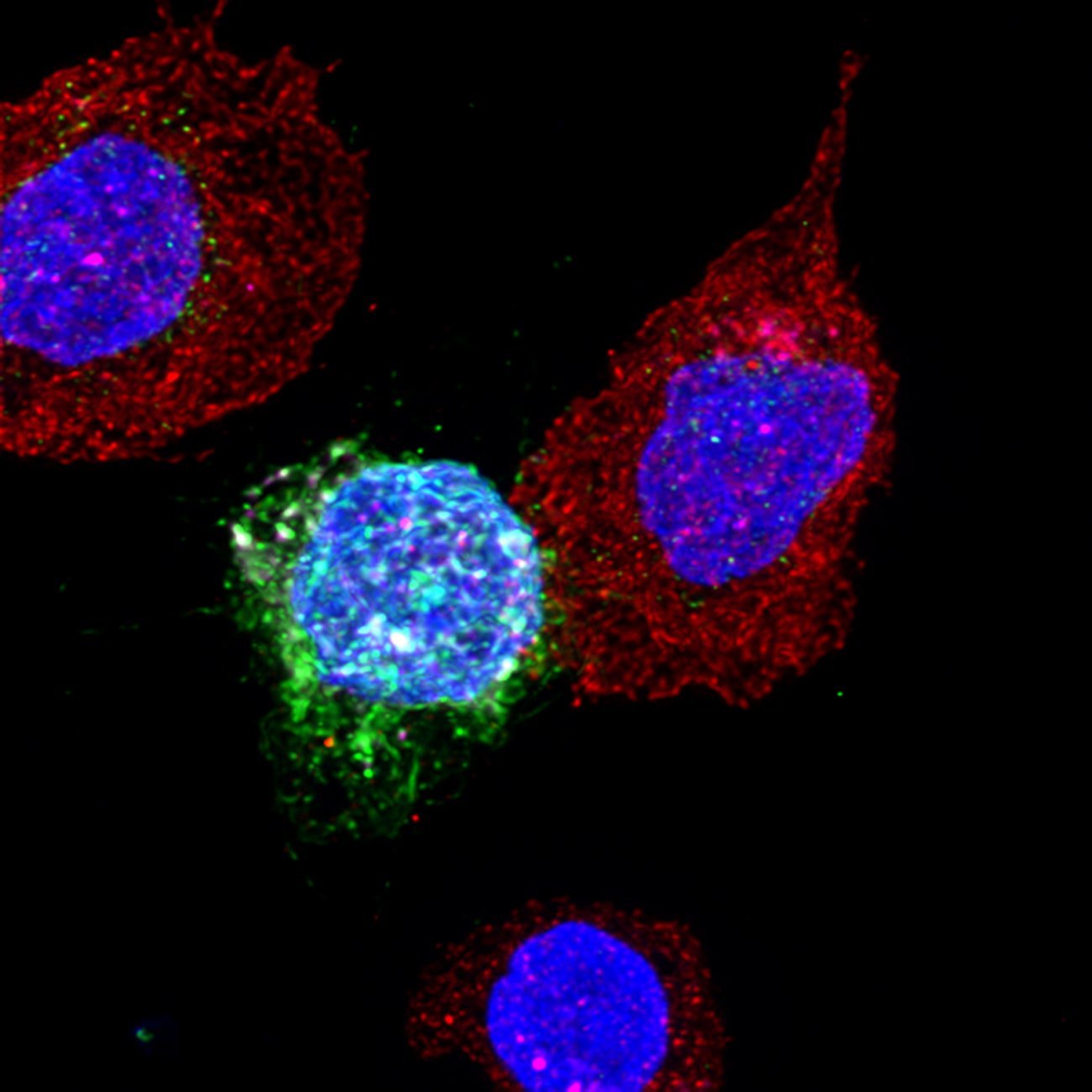 Cellules CD8 de patients contrôleurs en contact avec des cellules CD4 infectées par le VIH Cellules CD8 de patients contrôleurs en contact avec des cellules CD4 infectées par le VIH