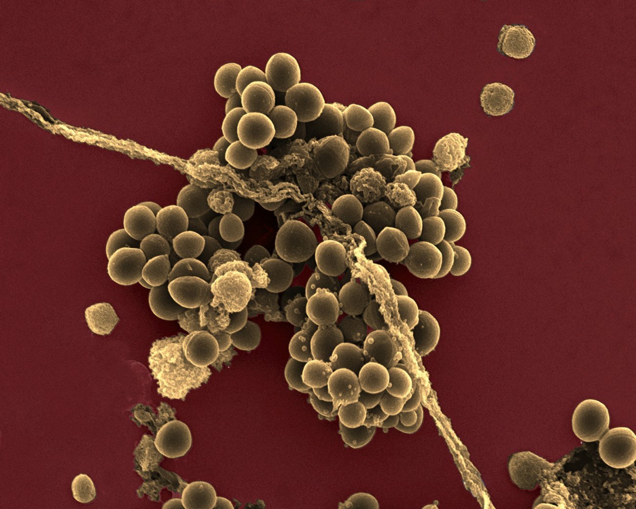 Bactéries Staphylococcus aureus (staphylocoque doré) vues en microscopie électronique à balayag Bactéries Staphylococcus aureus (staphylocoque doré) vues en microscopie électronique à balayag