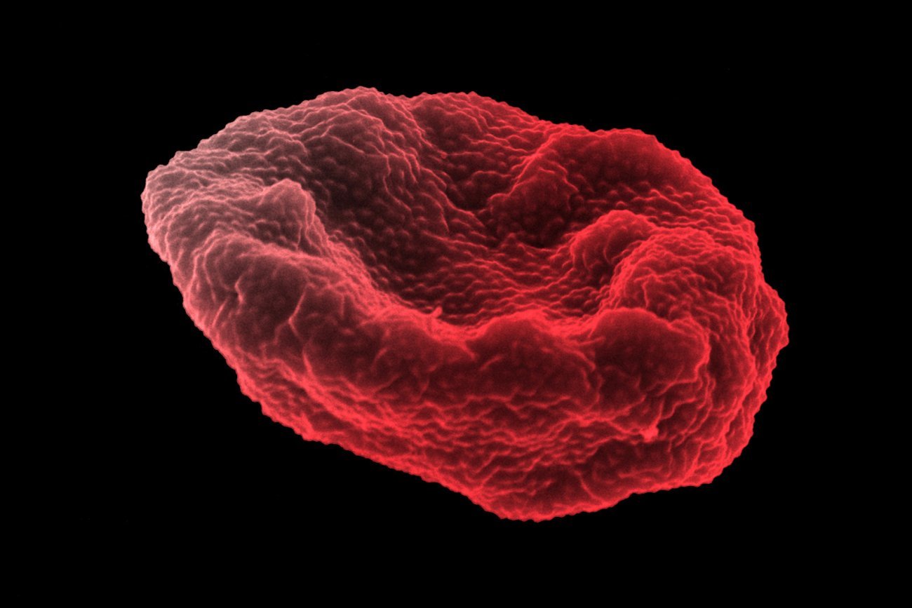 Globule rouge humain infecté par Plasmodium falciparum Globule rouge humain infecté par Plasmodium falciparum