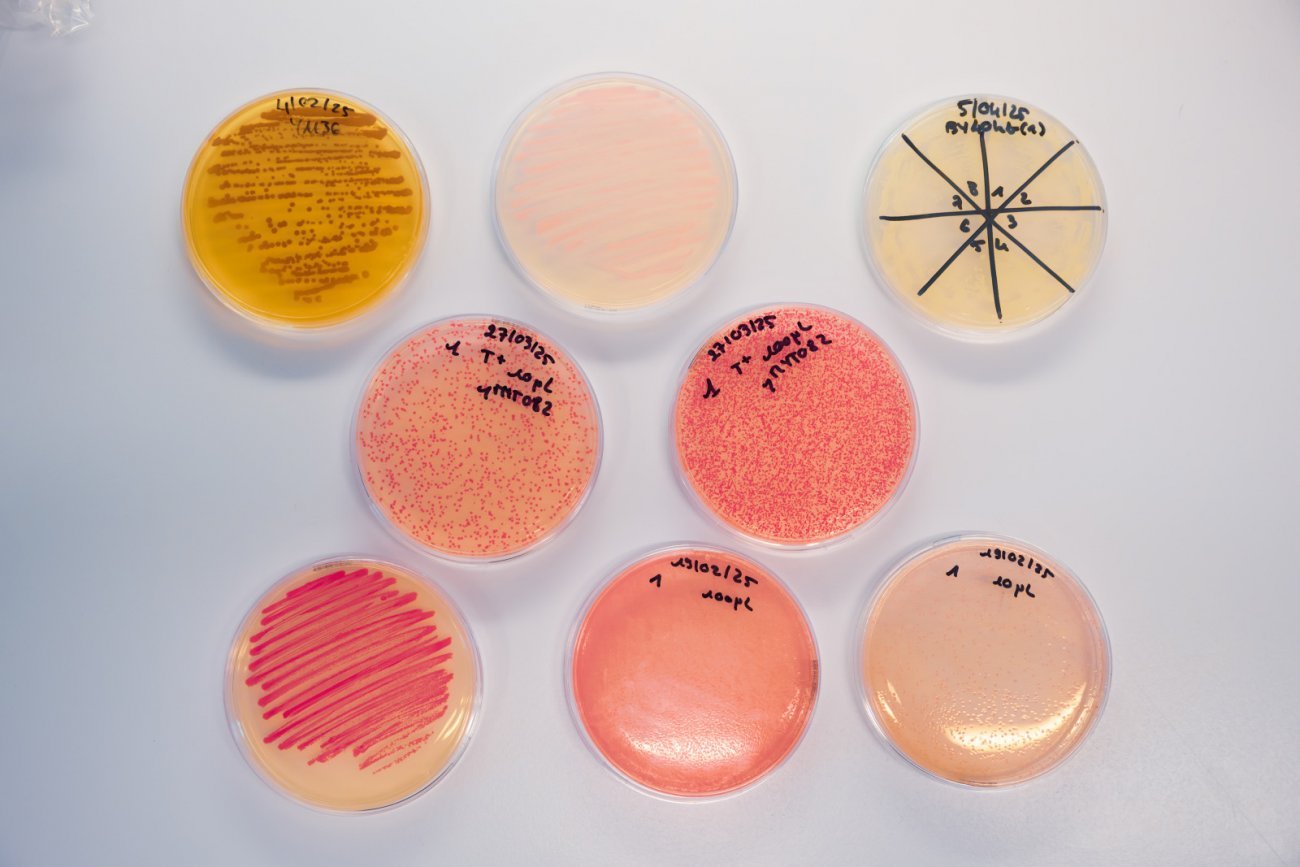 Différentes boites de Petri avec levures et bactéries Différentes boites de Petri avec levures et bactéries