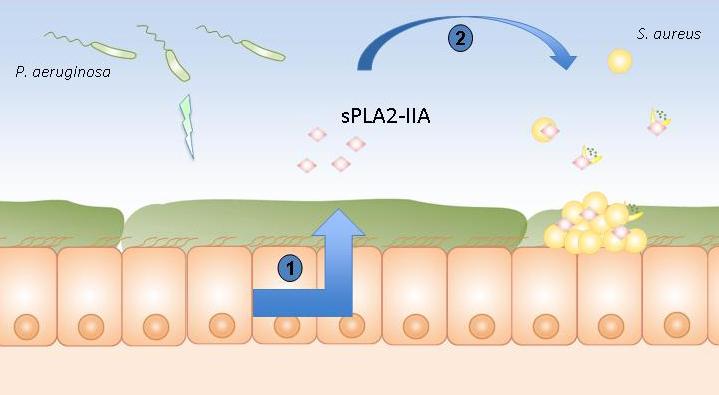 Epithélium pulmonaire de patients atteints de mucoviscidose, © Lhousseine Touqui, Institut Pasteur