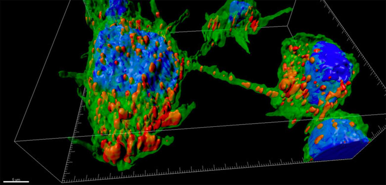 Des nanotubes permettent la diffusion de la maladie de Parkinson - Institut Pasteur