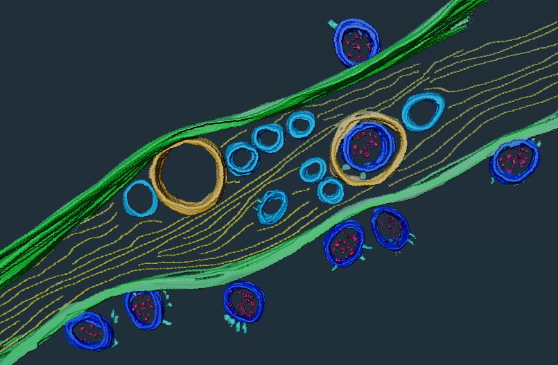 How SARS-CoV-2 hijacks human cells to evade i