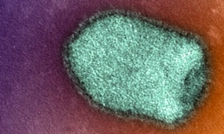 Virus de la rage en microscopie électronique - Institut Pasteur
