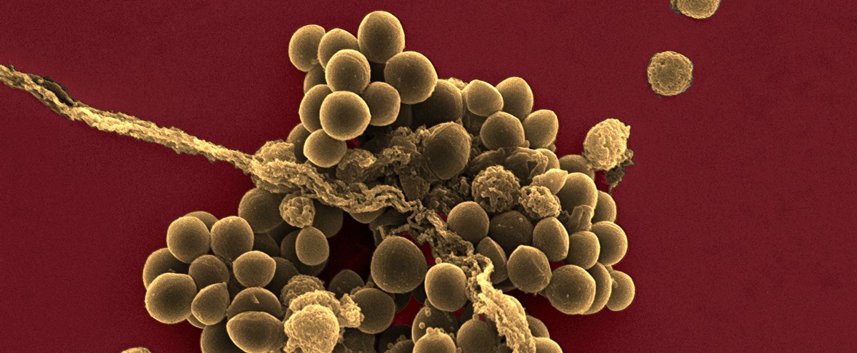 Distinguishing Deadly Staph Bacteria from Harmless Strains