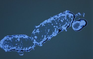 Bordetella pertussis ou bacille de Bordet Gengou. Coccobacille à Gram négatif, aérobie strict, encapsulé au sortir de l'organisme, immobile. Bactérie fragile et difficile à cultiver. Agent de la coqueluche, maladie respiratoire aigüe pouvant être mortelle