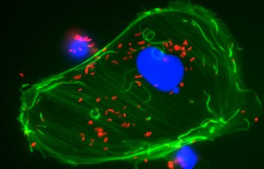 Observation en microscopie à fluorescence d'une cellules infectée par Listeria ©  Institut Pasteur/Edith Gouin et Pascale Cossart