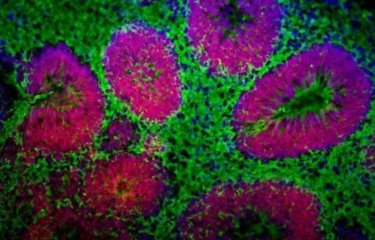 organoides-cerebraux-microscope © SupBiotech/Institut Pasteur