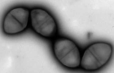 Chainette de Streptococcus pneumoniae en microscopie électronique à transmission.