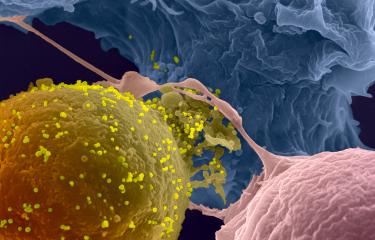 Sida : des anticorps capables d’éliminer les cellules infectées